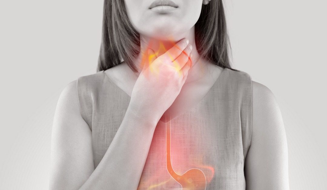 Common Causes of Heartburn and How to Treat It